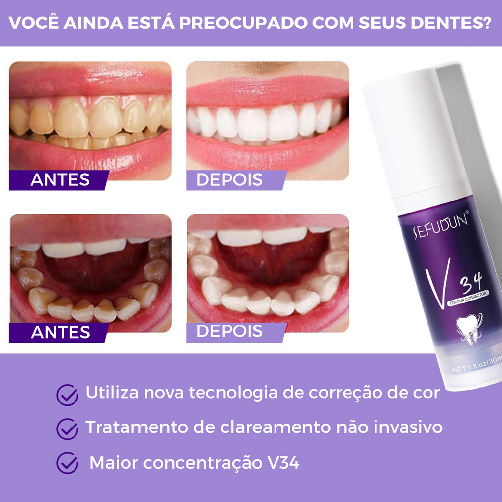 Matizador dental: será que ele, de fato, funciona? - ELLE Brasil